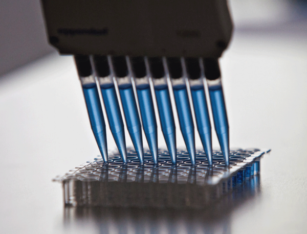 pNF-H ELISA (quant.)