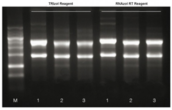 RNAzol RT Reagent